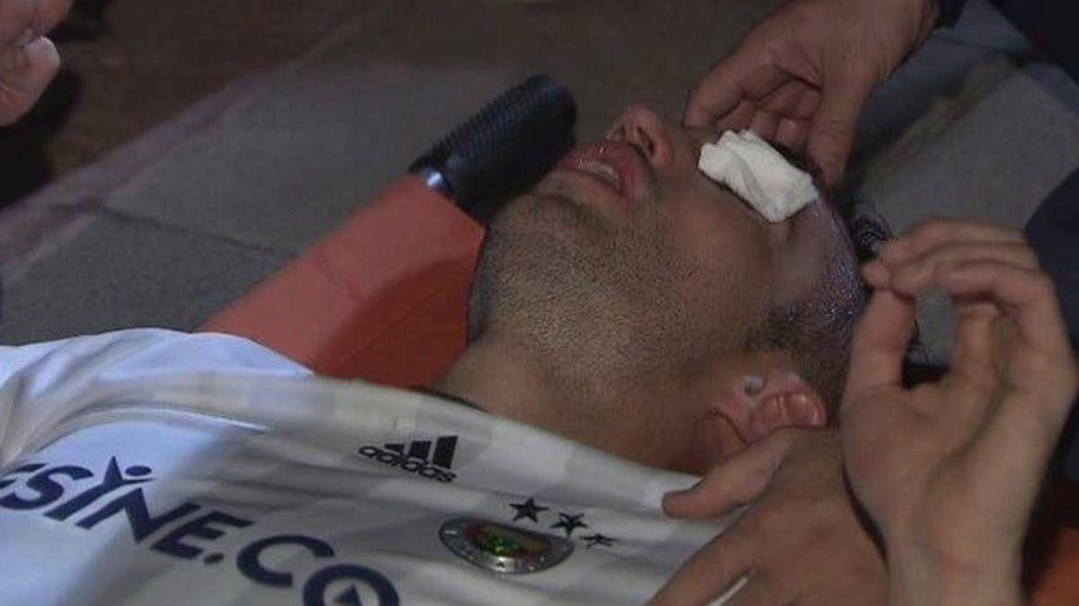 El holandés sufrió un golpe en el ojo izquierdo (@Pa_Ward1)