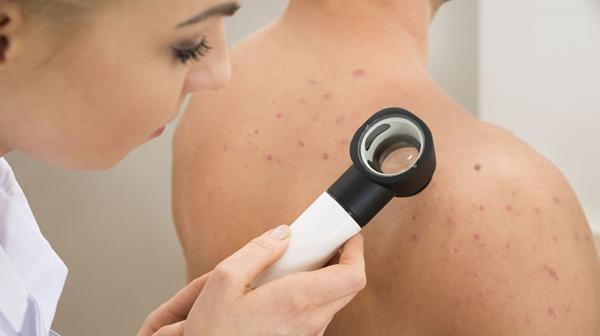 Es importante consultar a un dermatólogo especializado para que detecte la hidradenitis supurativa (iStock)