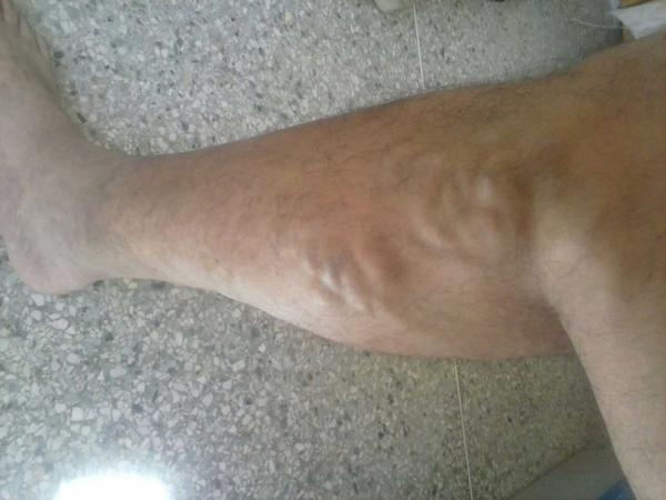 Así se encuentra Efraín por las torturas y su delicado estado de salud