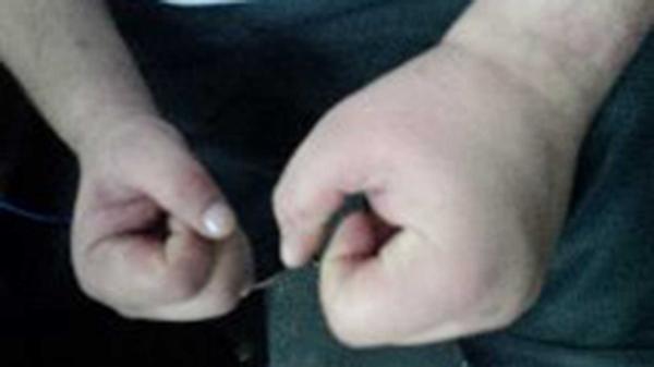 Efraín sufrió de escabiosis por las insalubres condiciones en la prisión de El Rosal