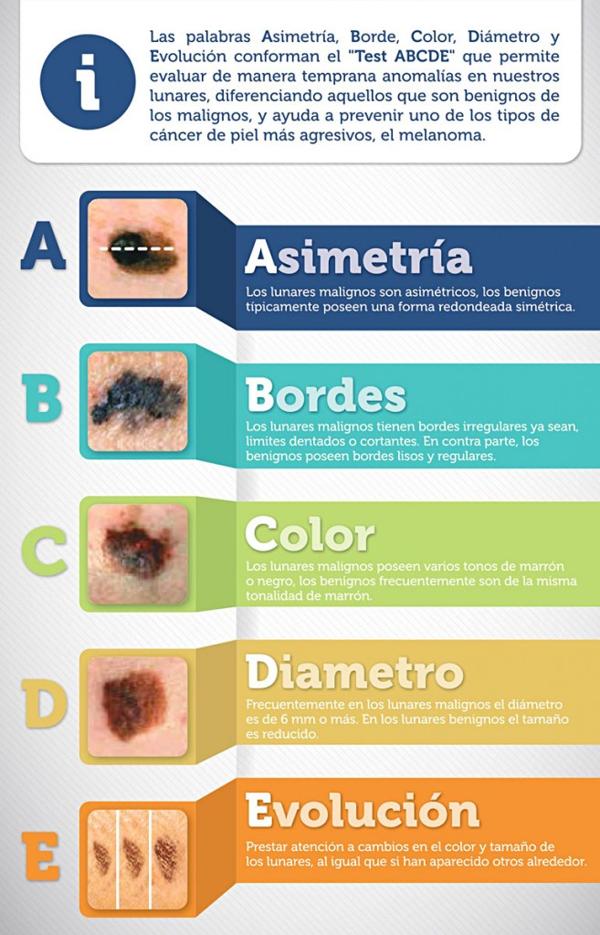 El método ABCDE para revisar lunares y manchas de la piel (MSD Oncología)