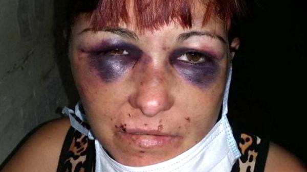 Así quedó Mariela, la mujer golpeada