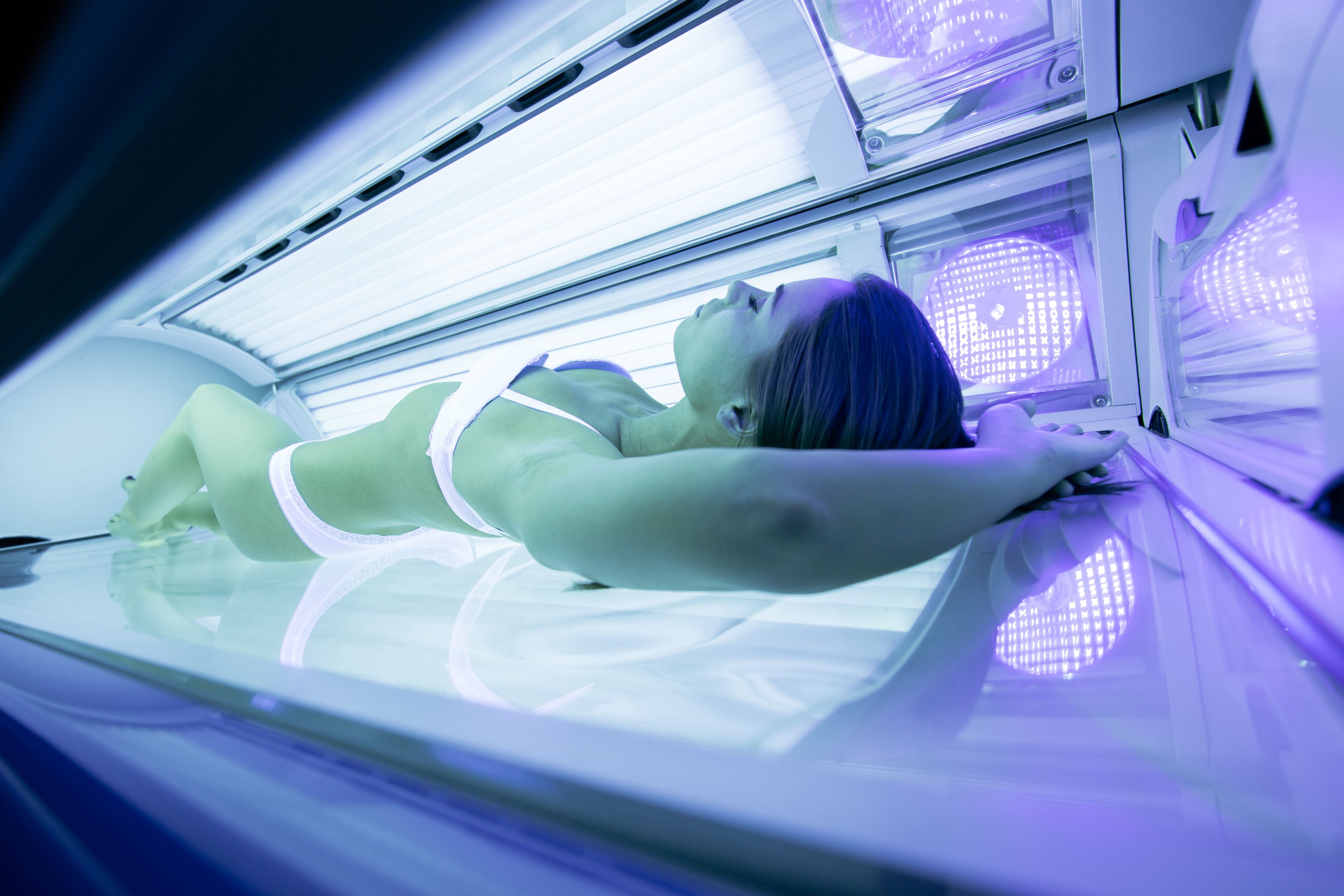 La asociación entre la exposición acumulativa a cama solar y el riesgo de desarrollar carcinoma de células escamosas es el mismo para todas las mujeres, sin importar la duración de su uso o la edad de iniciación (Shutterstock)