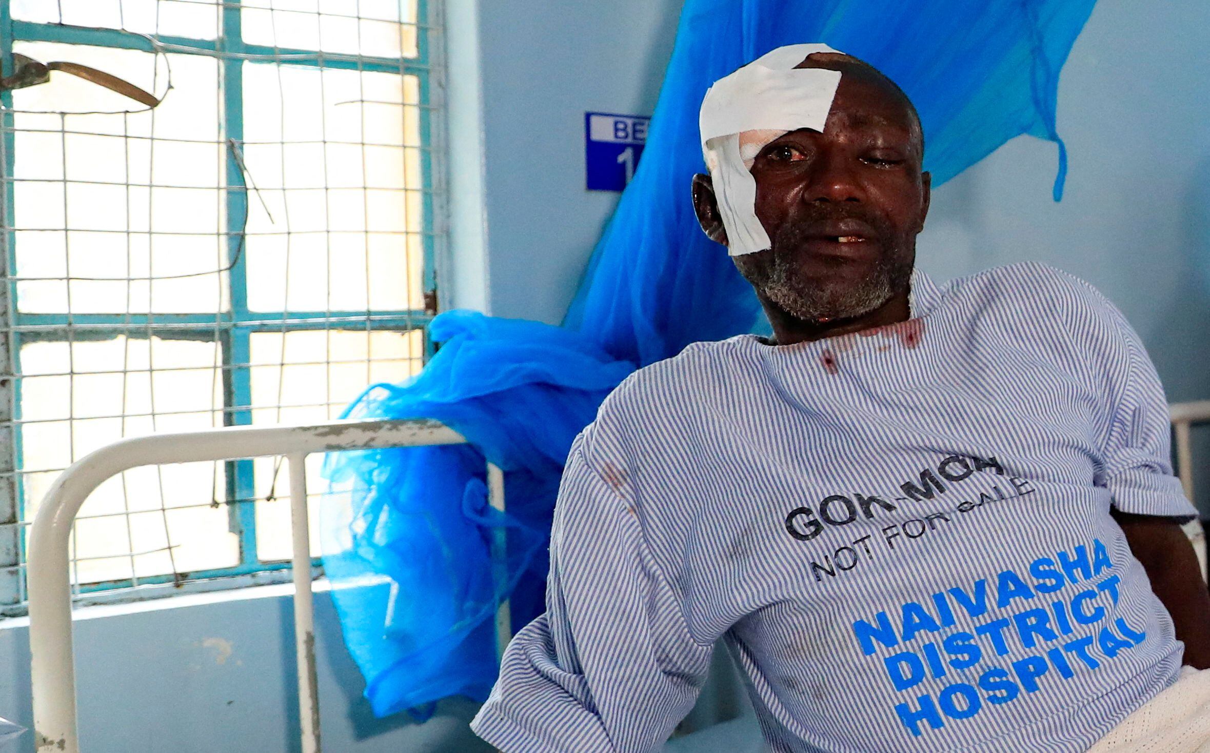 John Macharia, de 54 años, se recupera de las heridas causadas por la repentina inundación en el hospital zonal de Naivasha, tras la rotura de la represa en Kamuchiri, Mai Mahiu, condado de Nakuru