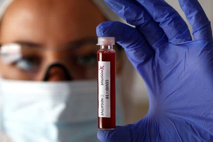 Por qué las pruebas son la clave para detener el avance del coronavirus en  México - Infobae