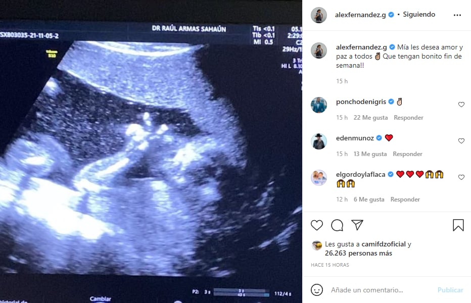 (Screenshot: @alexfernandez .g/instagram)