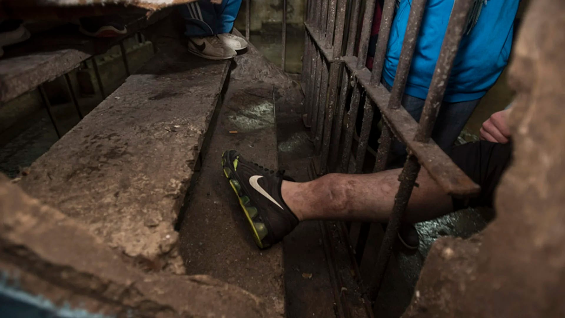 Olmos: un preso muestra su pierna infectada (MPF).