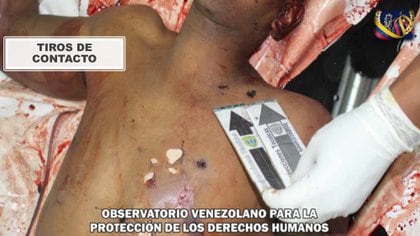 Masacre de Macuto - Operación Gedeón