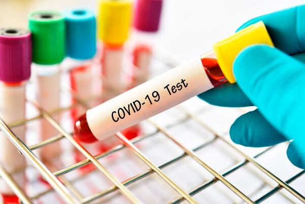 Se calcula alrededor de un año para que aparezcan las vacunas para el coronavirus (Shutterstock)