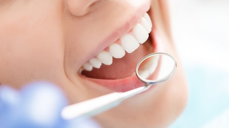 Los deportistas deben realizar una consulta al odontólogo cada seis meses para evitar la presencia de caries, gingivitis o enfermedad periodontal (Shutterstock)