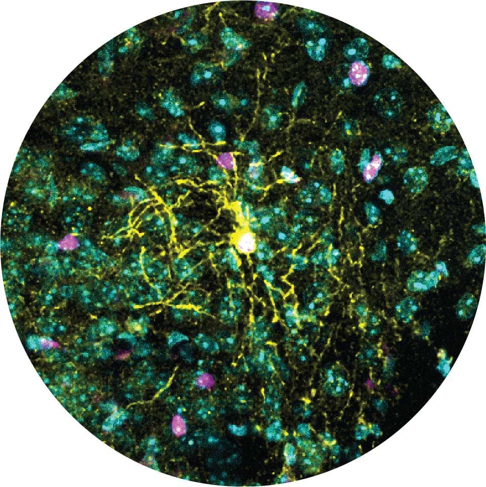 Una sección del cerebro de un ratón bajo el microscopio. El color amarillo muestra la estructura compleja de un oligodendrocito maduro, con numerosas ramificaciones que llegan a las células circundantes