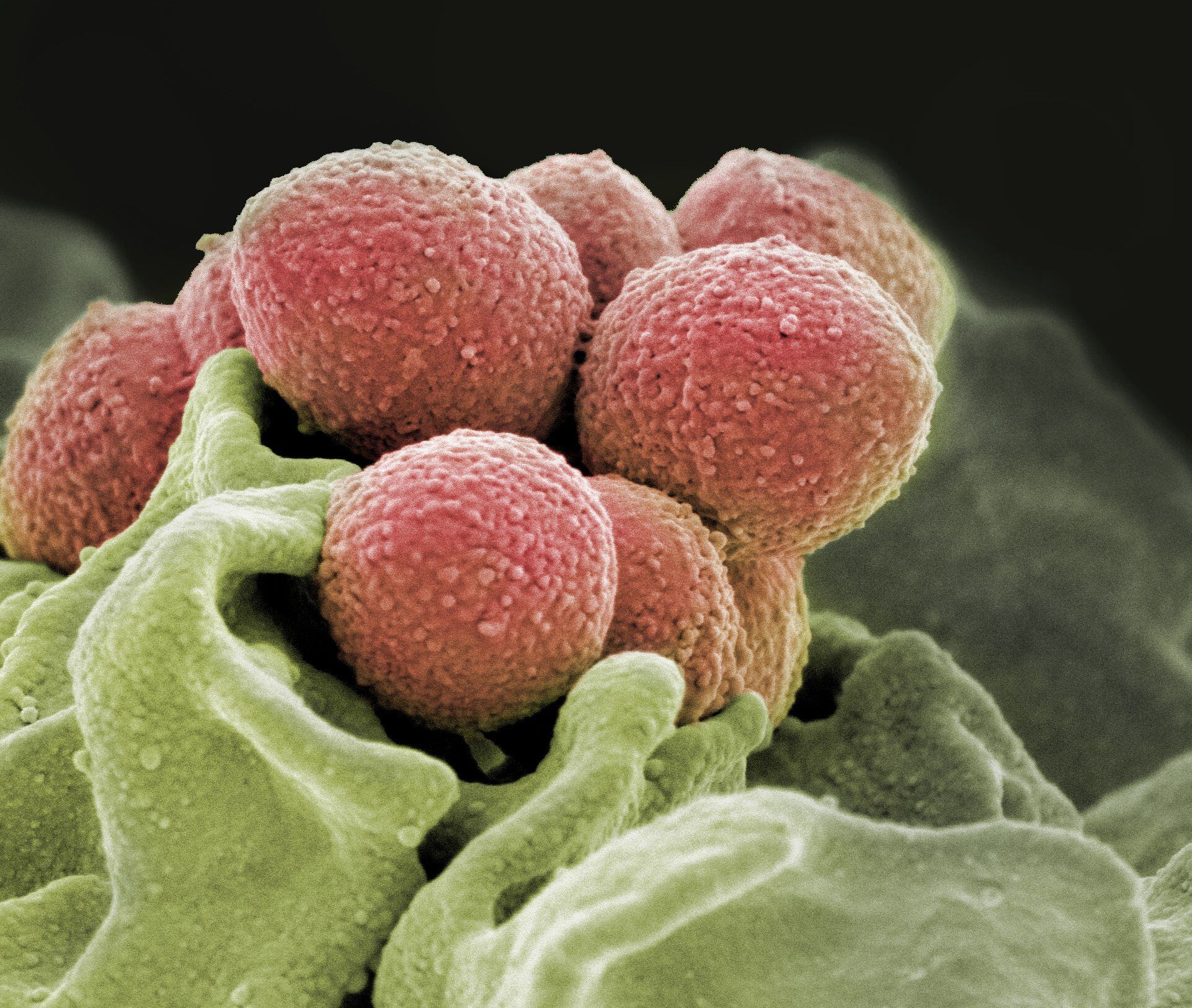 scanning electron microscope image of Staphylococcus pyogenes bacteria (pink).  CREDIT NIH National Institute of Allergy and Infectious Diseases (NIAID)