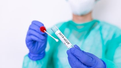 En la pandemia de coronavirus, como en tantas otras crisis de salud pública relacionadas con enfermedades infecciosas, se está utilizando para determinar si una persona está infectada o no con coronavirus (Shutterstock)