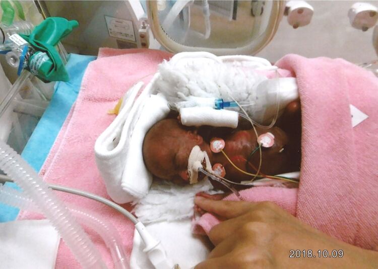 El en la sala neonatal. (Photo by Handout / Nagano Children’s Hospital / AFP)