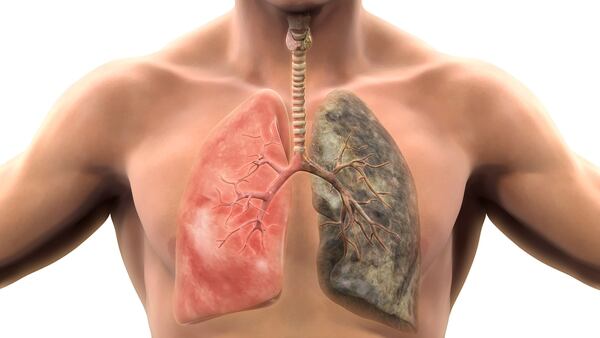 Un pulmón sano y otro bajo lo efectos del tabaco (Shutterstock)