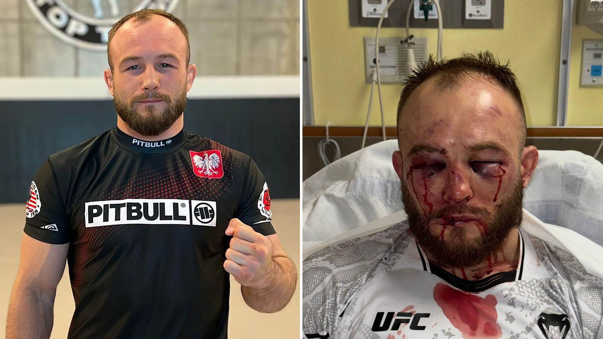 Un luchador mostró su rostro tras una pelea