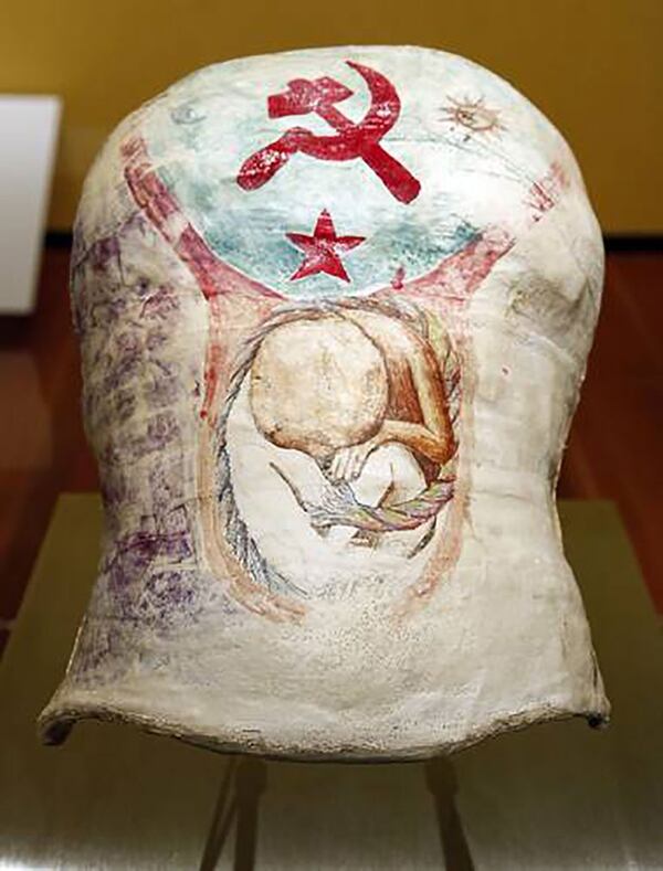 Uno de los corsés de yeso de Frida: los signos del comunismo y la imagen de un feto.