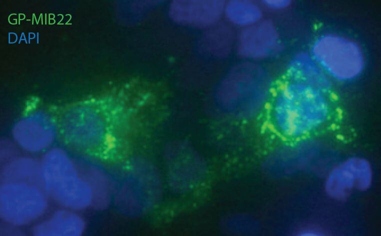 The researchers incubated the MIB22 antibody (green) with human kidney cells coated with a protein from Andean hantavirus (blue). This material relates to a paper that appeared in the Nov. 21, 2018, issue of <i>Science Translational Medicine</i>, published by AAAS. The paper, by J.L. Garrido at Universidad de Concepci&oacute;n in Concepci&oacute;n, Chile; and colleagues was titled, "Two recombinant human monoclonal antibodies that protect against lethal Andes hantavirus infection in vivo."CREDITJ.L. Garrido et al., Science Translational Medicine (2018)