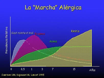 Los médicos evalúan lo que denominan "marcha alérgica"