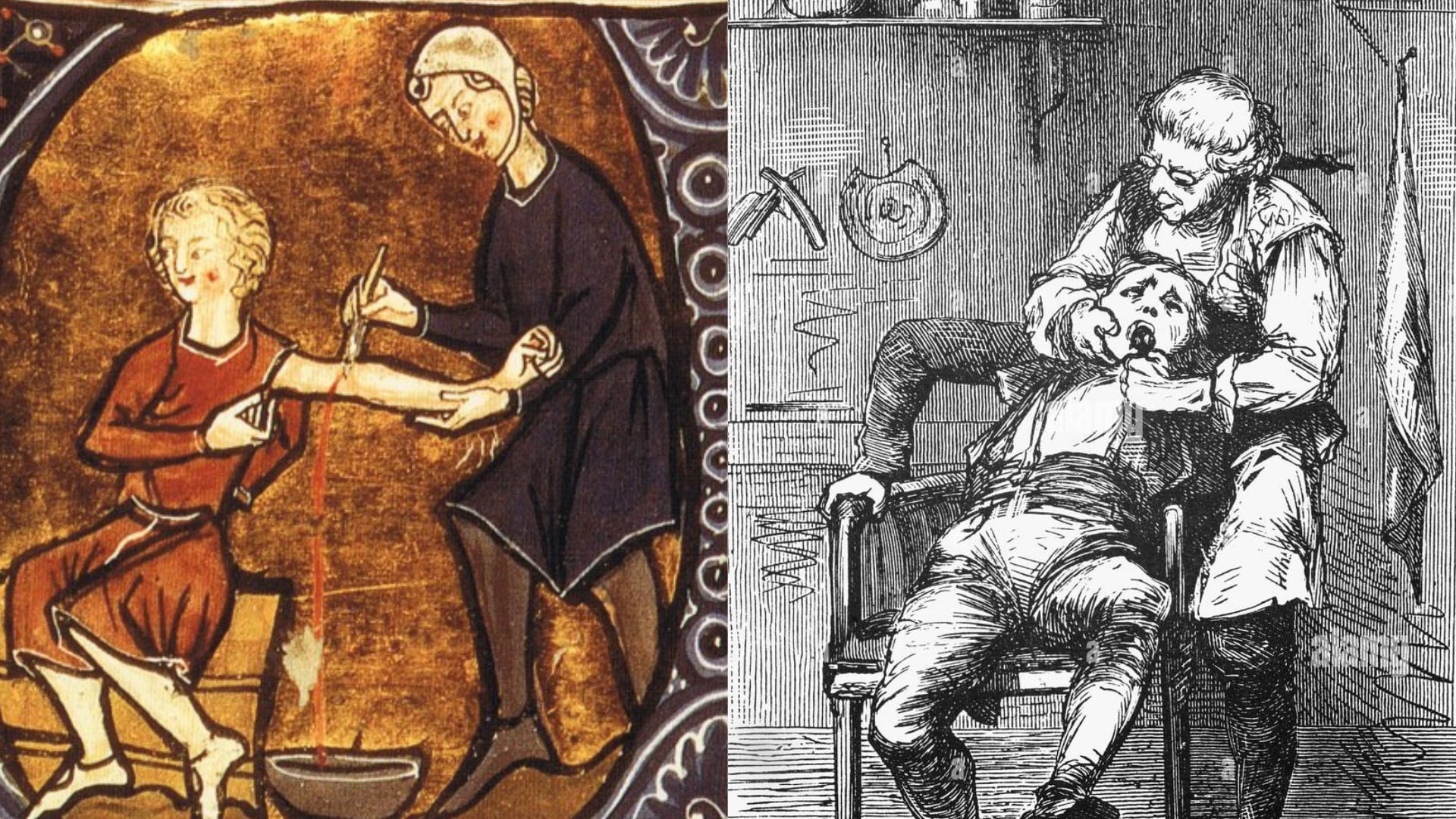Clérigo y barbero realizando labores médicas