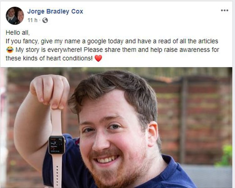 El Apple Watch le salvó la vida a Jorge Cox, un joven británico conun prblema cardíaco que tenía desde su nacimiento. (Foto: Archivo)