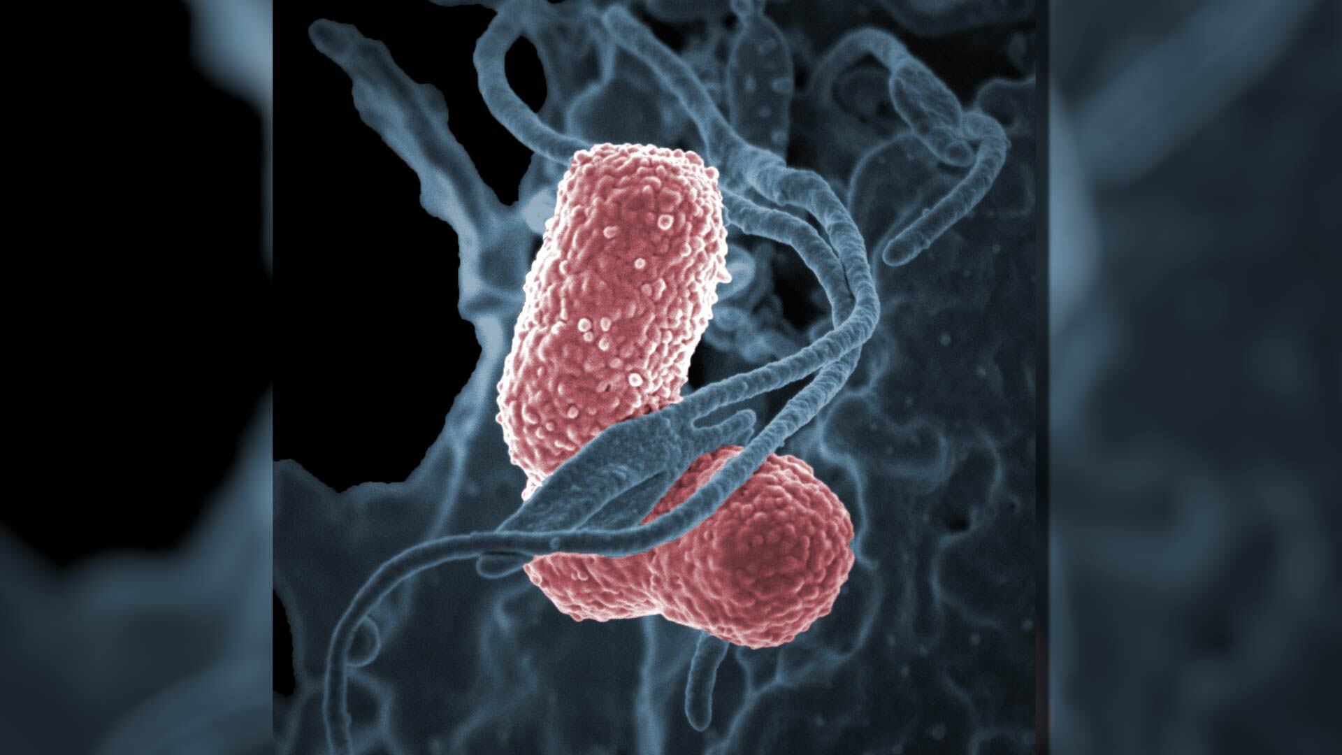 Bacteria Klebsiella pneumoniae