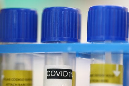 La enfermedad COVID-19 modificó los protocolos médicos en todo el mundo - REUTERS/Denis Balibouse