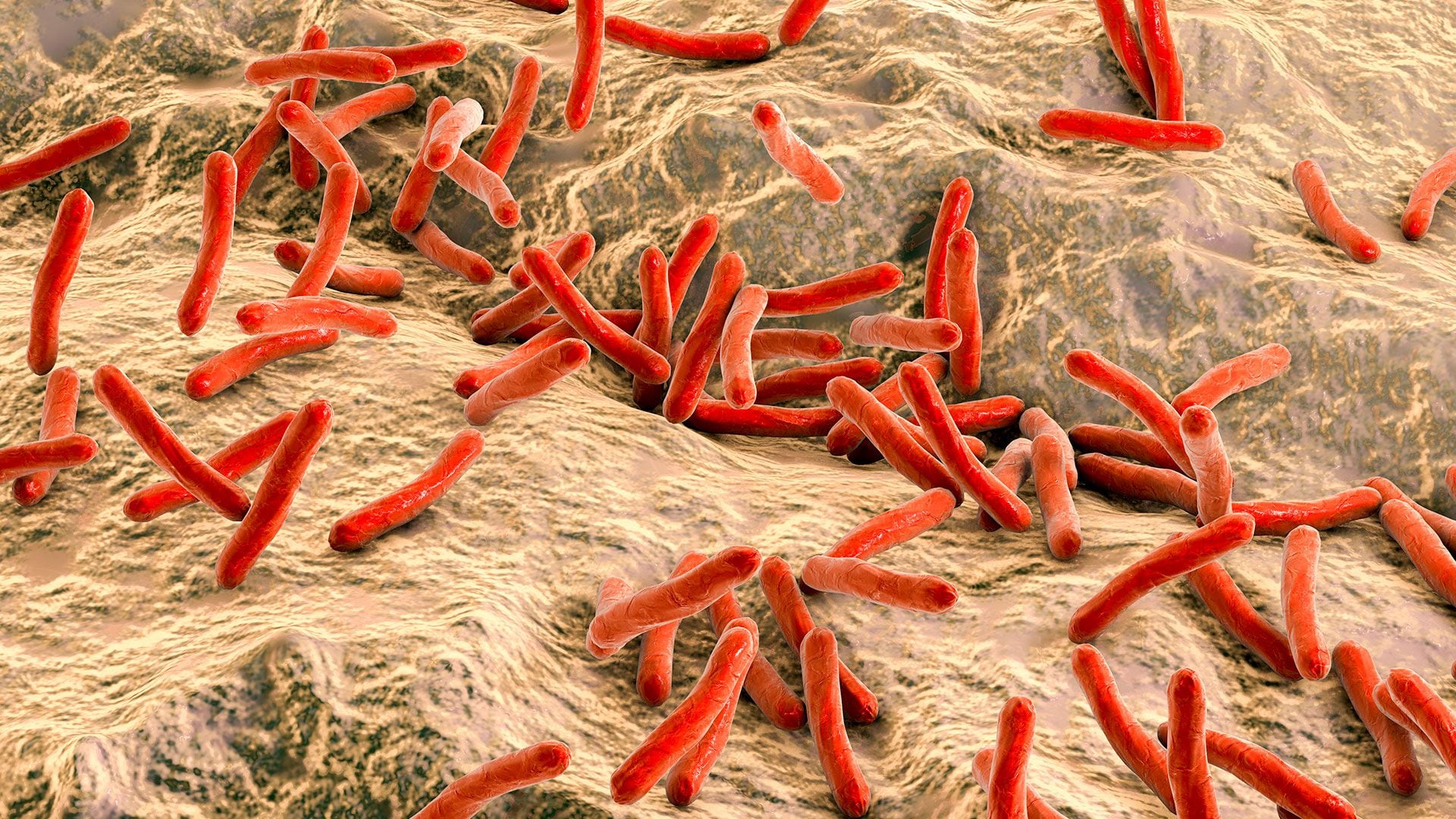 En América Latina, aún crecen los casos de lepra y tuberculosis. Por la reducción de la inmunización, hay riesgos de brotes de sarampión y poliomielitis (Getty Images)