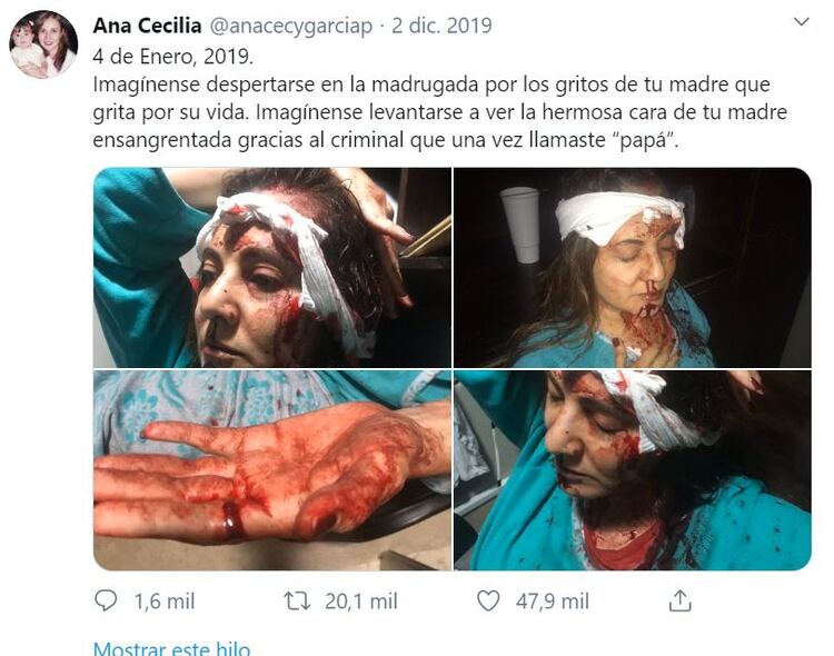 Así fue golpeada Abril en una riña con Juan Carlos antes de su muerte. (Foto: Twitter)