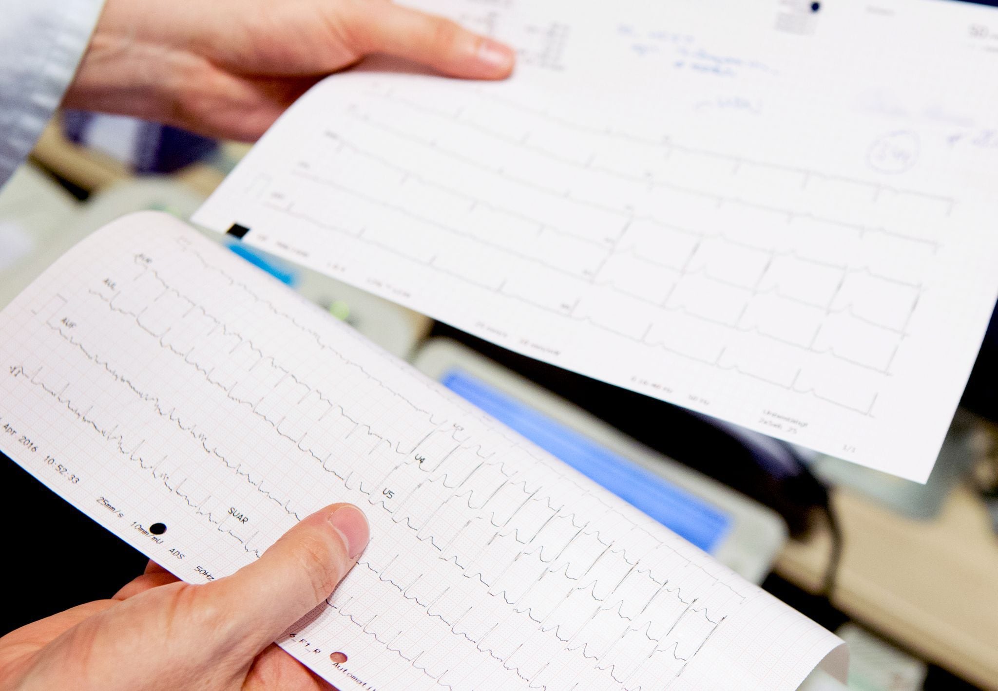 El electrocardiograma puede dar indicios sobre una insuficiencia cardíaca y otros problemas cardiovasculares (Oliver Krato/dpa)