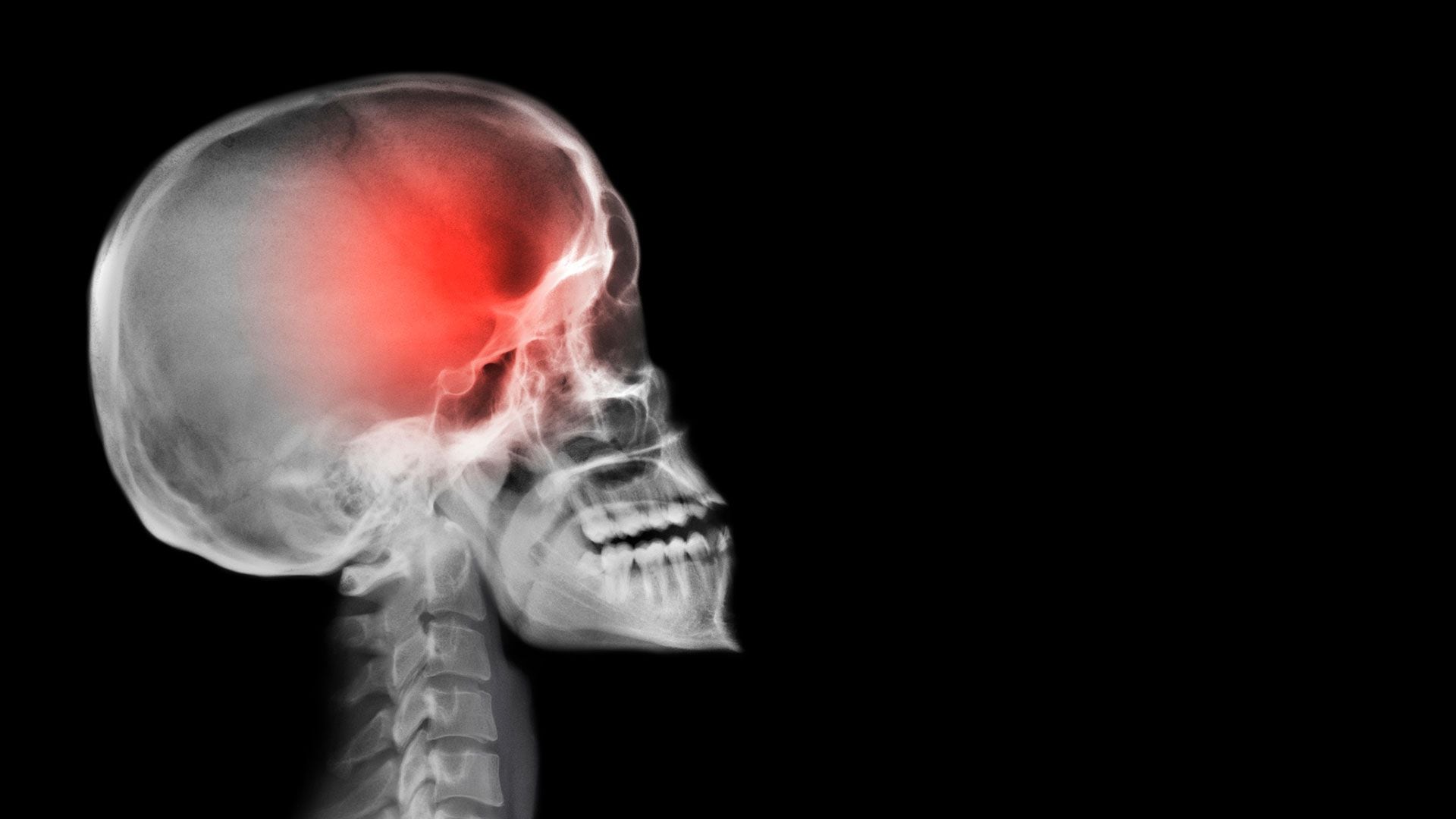 Hay tumores que los médicos no saber cómo y dónde se originaron (Getty Images)