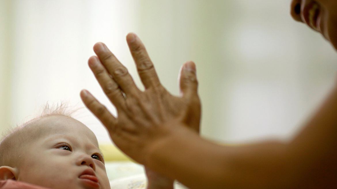 La incidencia del Síndrome de Down a nivel mundial es de 1 por cada 100 mil recién nacidos (Foto: Reuters)