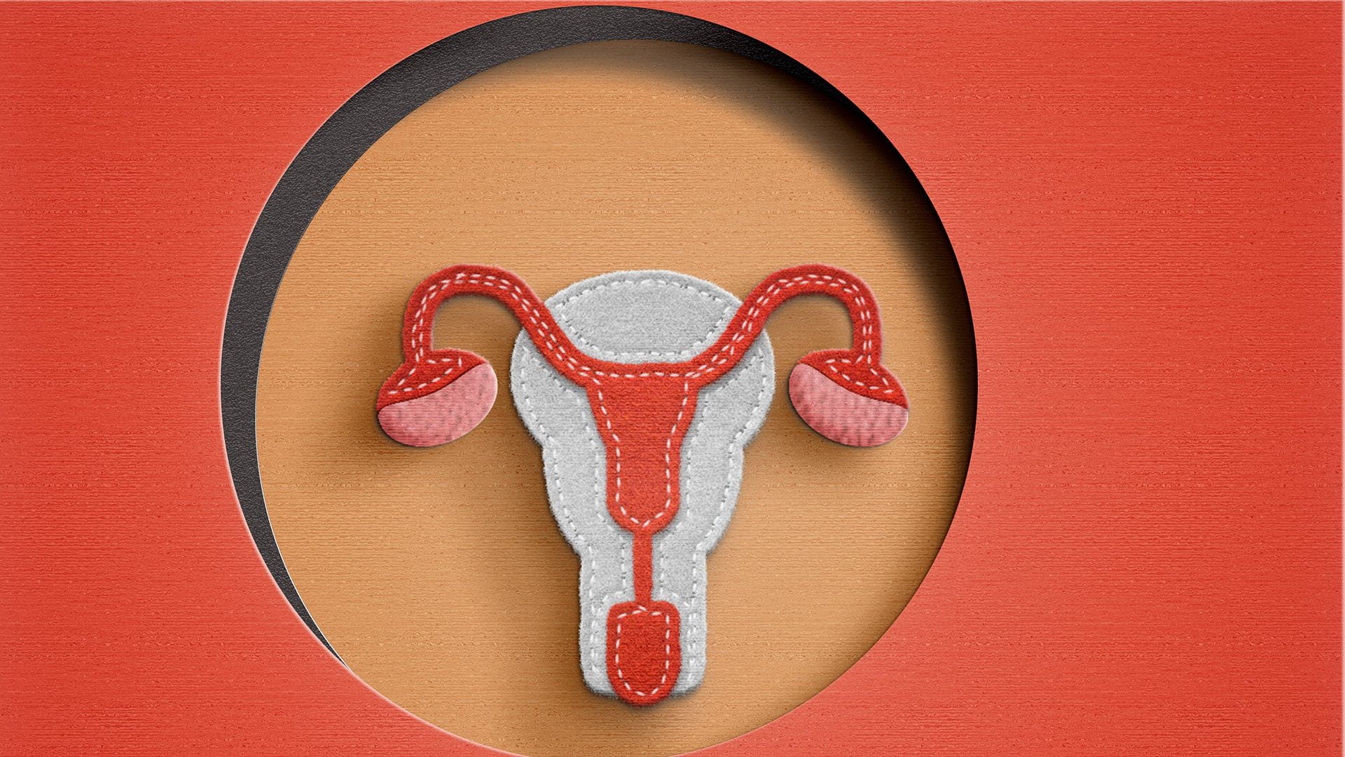 "Si el cáncer de ovario se detecta en etapas tempranas, el tratamiento funciona mejor", advierten desde los CDC / Getty