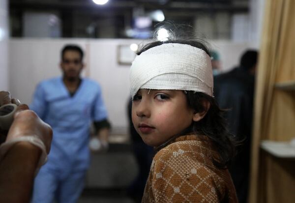 Centros médicos de Siria reciben a niños heridos por los bombardeos en Guta Oriental (AFP PHOTO / Ammar SULEIMAN)