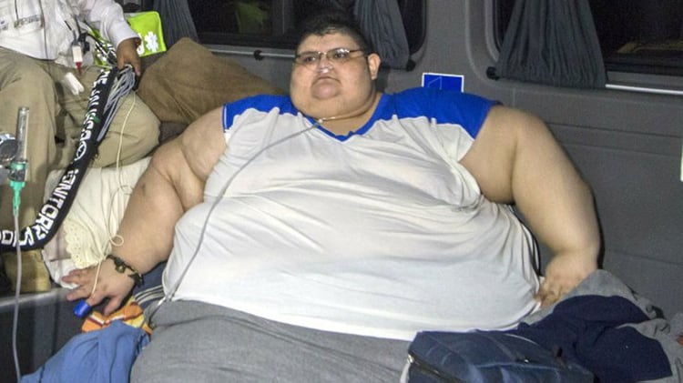 Juan Pedro 33 Anos Y Un Sueno Bajar 500 Kilos Para Poder Manejar