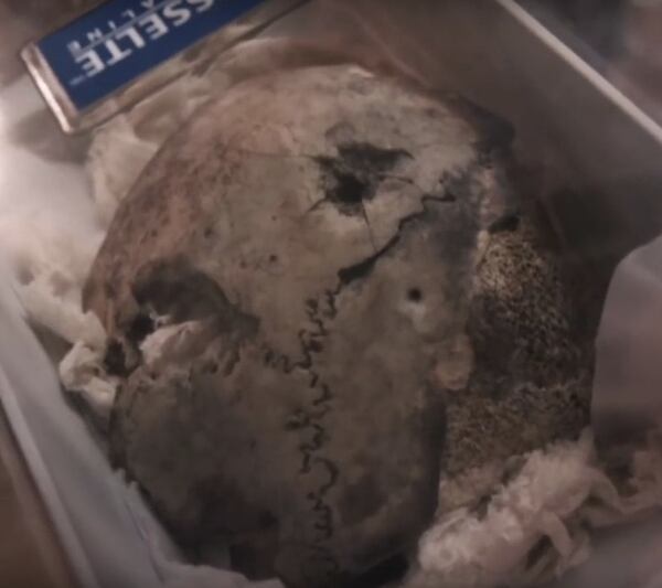 Fragmento del cráneo de Hitler (© Dailymotion/ Infrarouge, France 2)