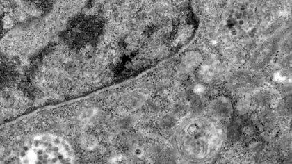 Partículas del virus SARS-COV-2 tomadas por microscopio en Brasil (EFE/EPA/Débora Barreto/FIOCRUZ HANDOUT)