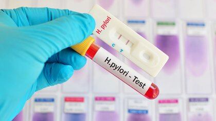 H. pylori se puede encontrar mediante prueba de sangre, prueba de aliento o prueba fecal (Shutterstock)