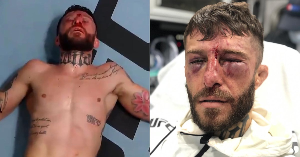 Marcelo “Pitbull” Rojo showed his aftermath after the defeat in his UFC debut: “I can still steal your girlfriend from you”