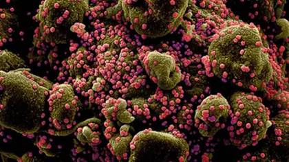 Investigadores descubrieron como el virus del herpes simple (VHS) evita el sistema inmunológico para causar infecciones