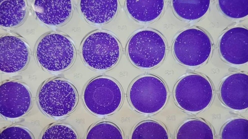  Placas de Petri, en las que se aplicaron los compuestos del grupo de plantas Asteraceae sobre células con el virus del dengue | Foto: Conicet    