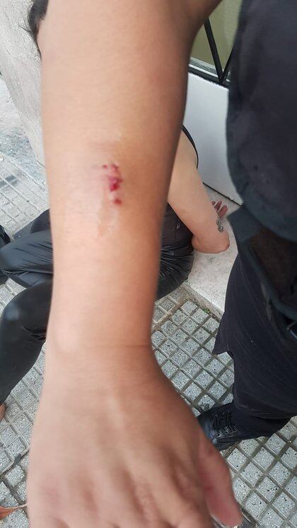 El brazo herido de la policía agredida