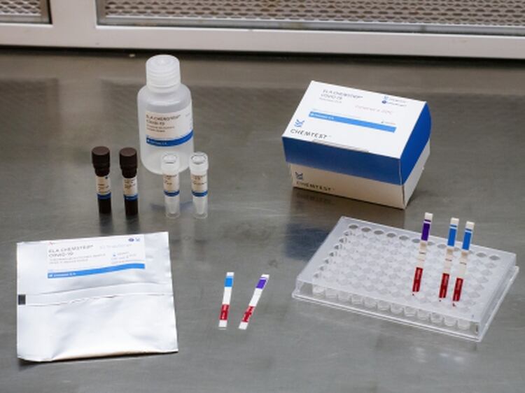 Coronavirus: científicos argentinos desarrollaron un test que ...