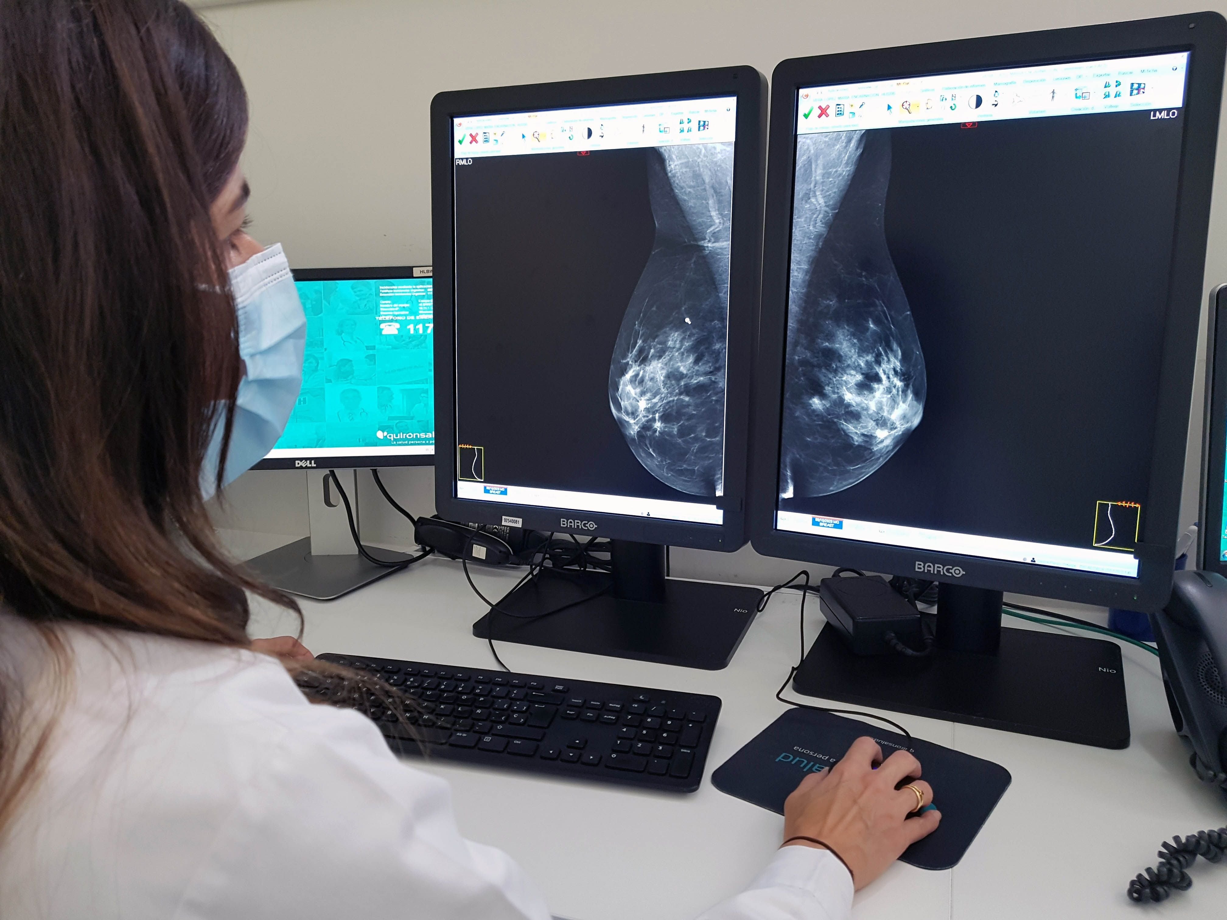El cáncer de mama es la primera causa de muerte por tumores en mujeres en la Argentina (Europa Press)