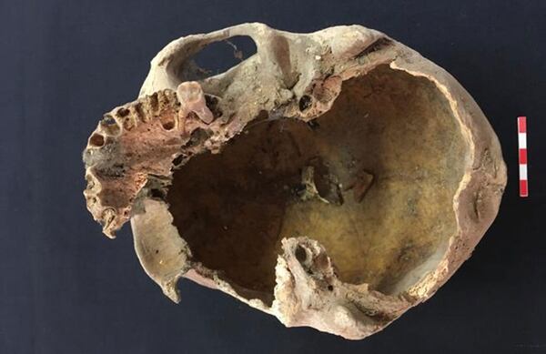 El supuesto cráneo de Arnau de Torroja. Un diente y un hermano del que fuera obispo enterrado en Tarragona serán claves para determinar si se trata efectivamente de los restos del ex gran maestre templario (Giampiero Bagni)