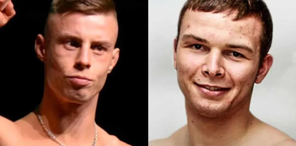 Dos luchadores terminaron con el rostro destrozado tras una brutal pelea
