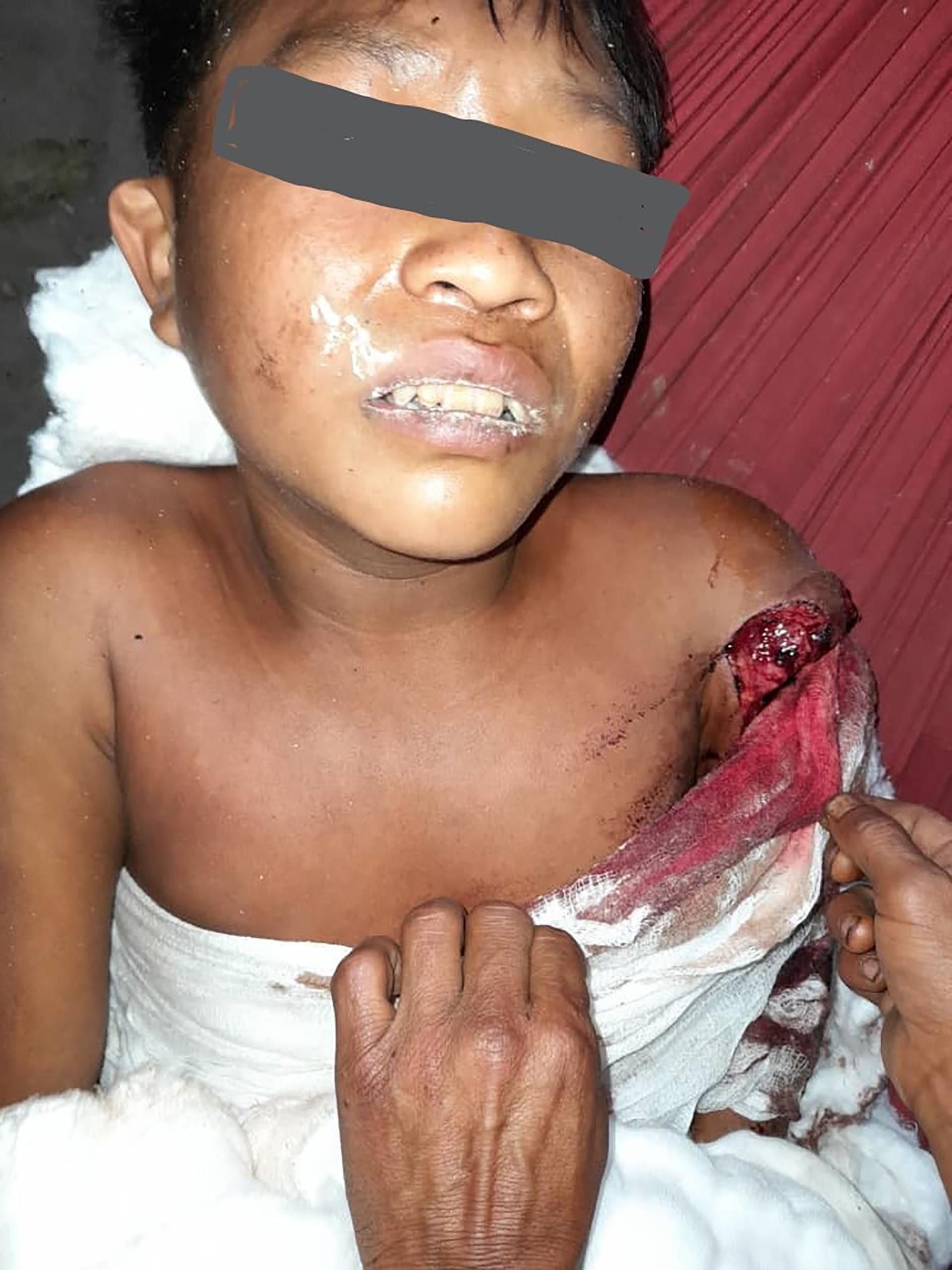 24 marzo 22 INFOBAE Yanomamis