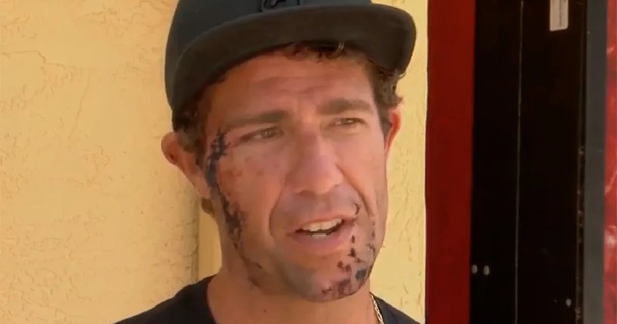 A surfer injured his face while swimming in Volusia, the ‘shark capital of the world’.