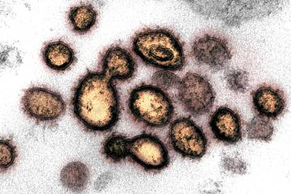 Esta imagen del microscopio electrónico muestra SARS-CoV-2, aislado de un paciente en los EEUU. Las partículas de virus se muestran emergiendo de la superficie de las células cultivadas en el laboratorio. Los picos en el borde exterior de las partículas del virus, en forma de corona, dan a los coronavirus su nombre (NIAID-RML a través de Reuters)