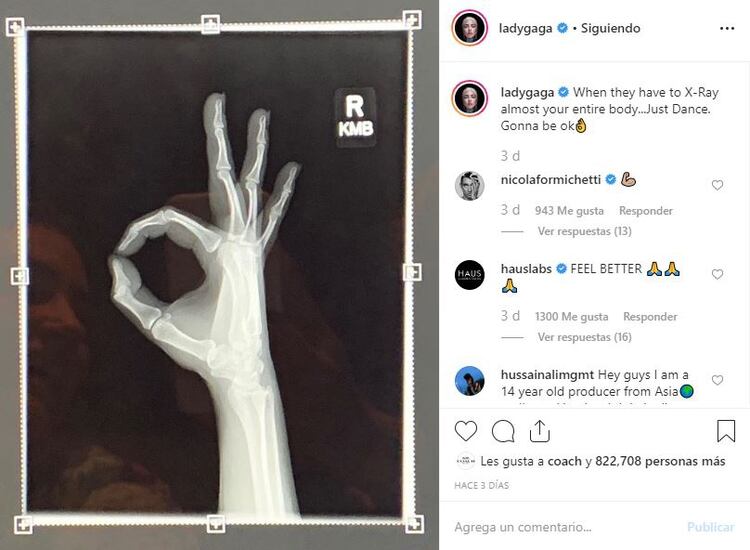La cantante de atuendos estrafalarios informó en su cuenta de Instagram que le realizaron una radiografía de cuerpo completo para descartar cualquier problema con su cuerpo. (Foto: Instagram)